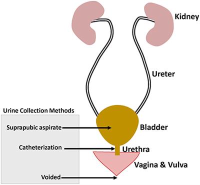 Frontiers | The Current Evidence On The Association Between The Urinary ...